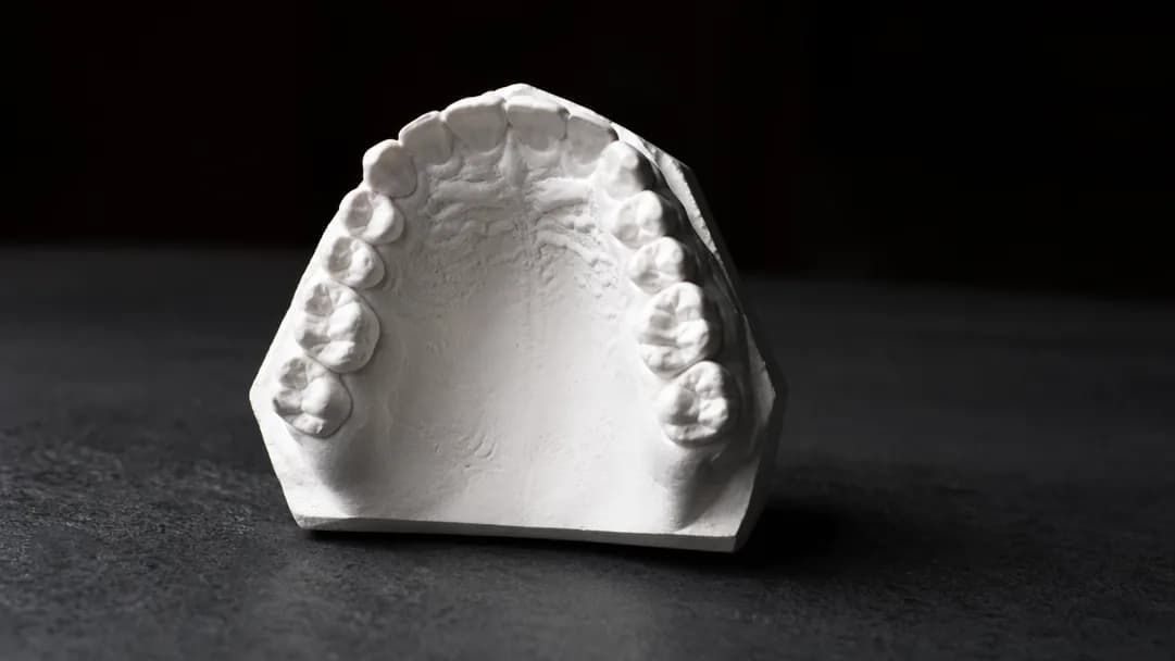 A plaster model of an upper arch on a dark surface, shot close under directional light