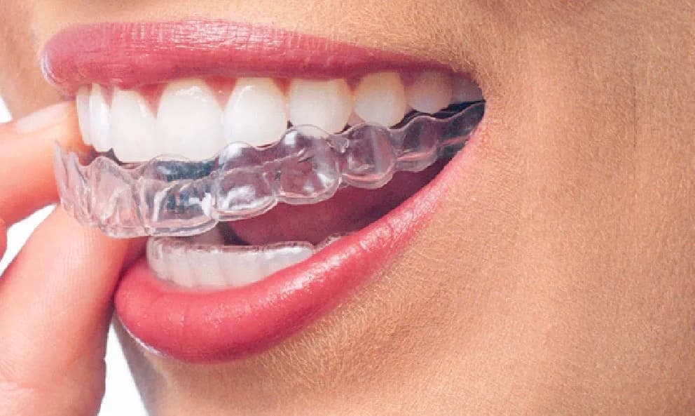 Appletree Dental Surgery — photo from their Google listing