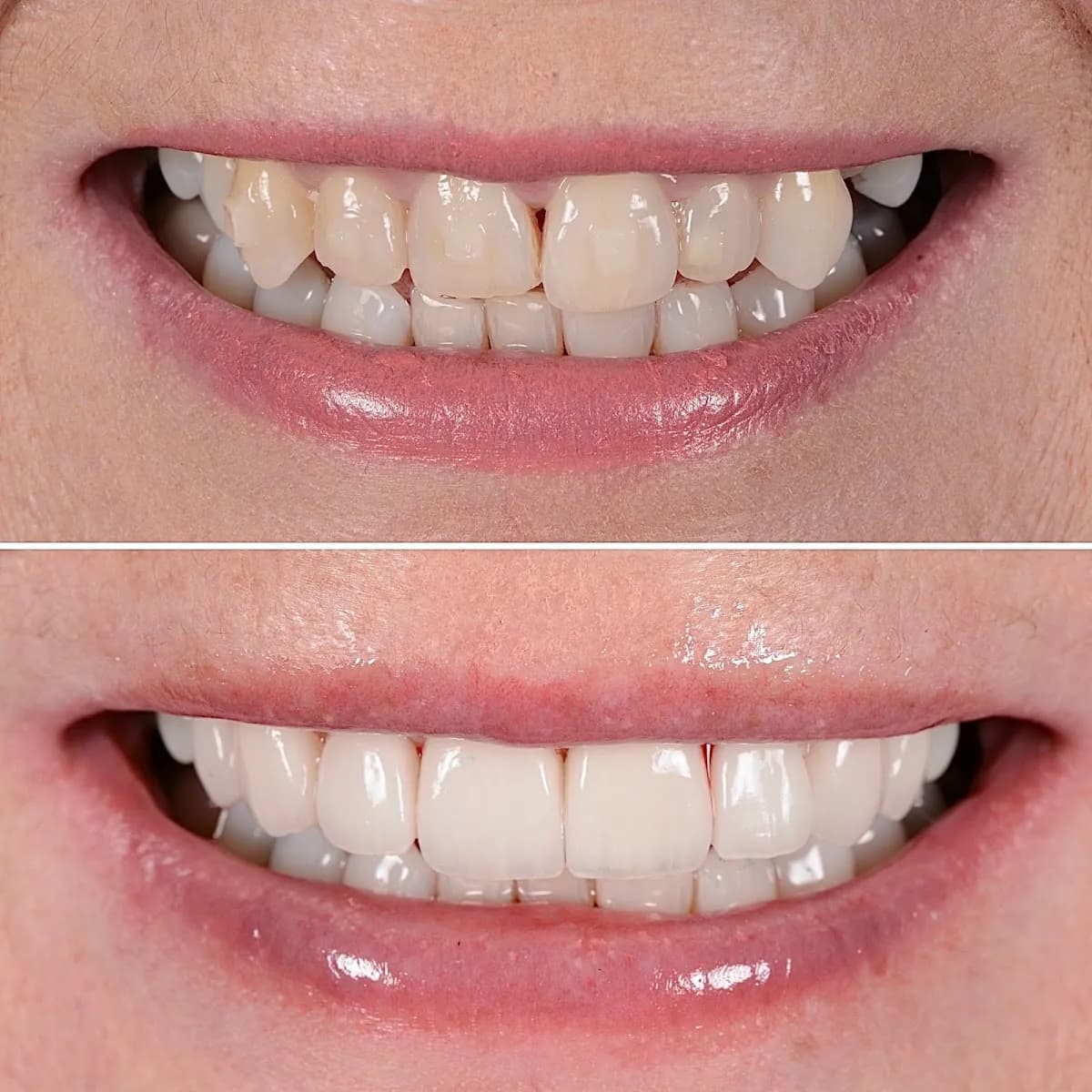 Bespoke Smile London — photo from their Google listing