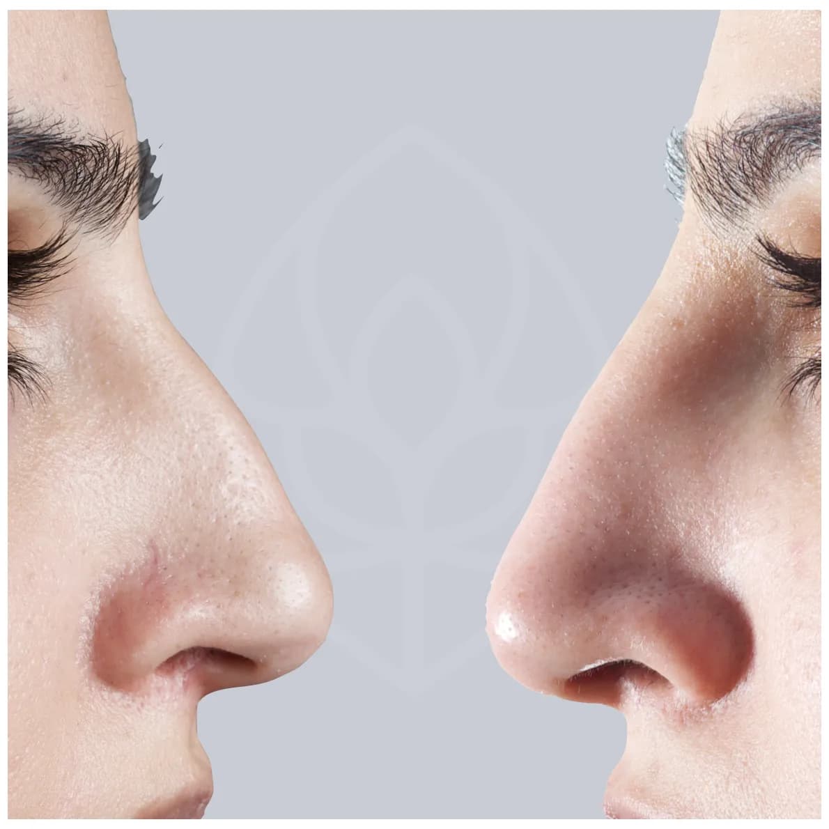 Bullsmoor Dental & Aesthetics Clinic — photo from their Google listing
