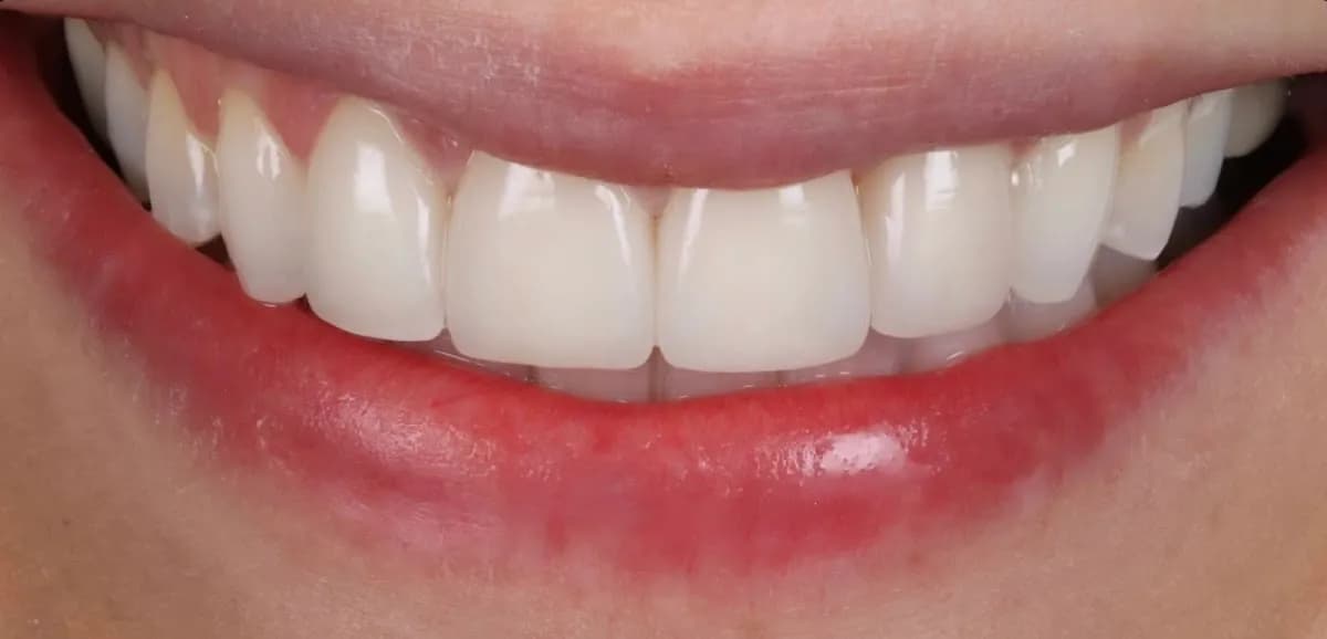 Bupa Dental Care Ladybridge, Bolton — photo from their Google listing