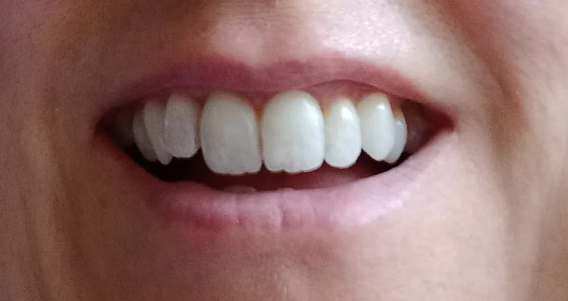 Burpham Dental Care — photo from their Google listing
