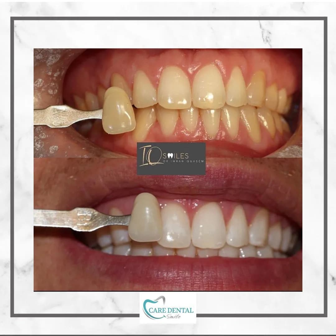 Care Dental Smile — photo from their Google listing