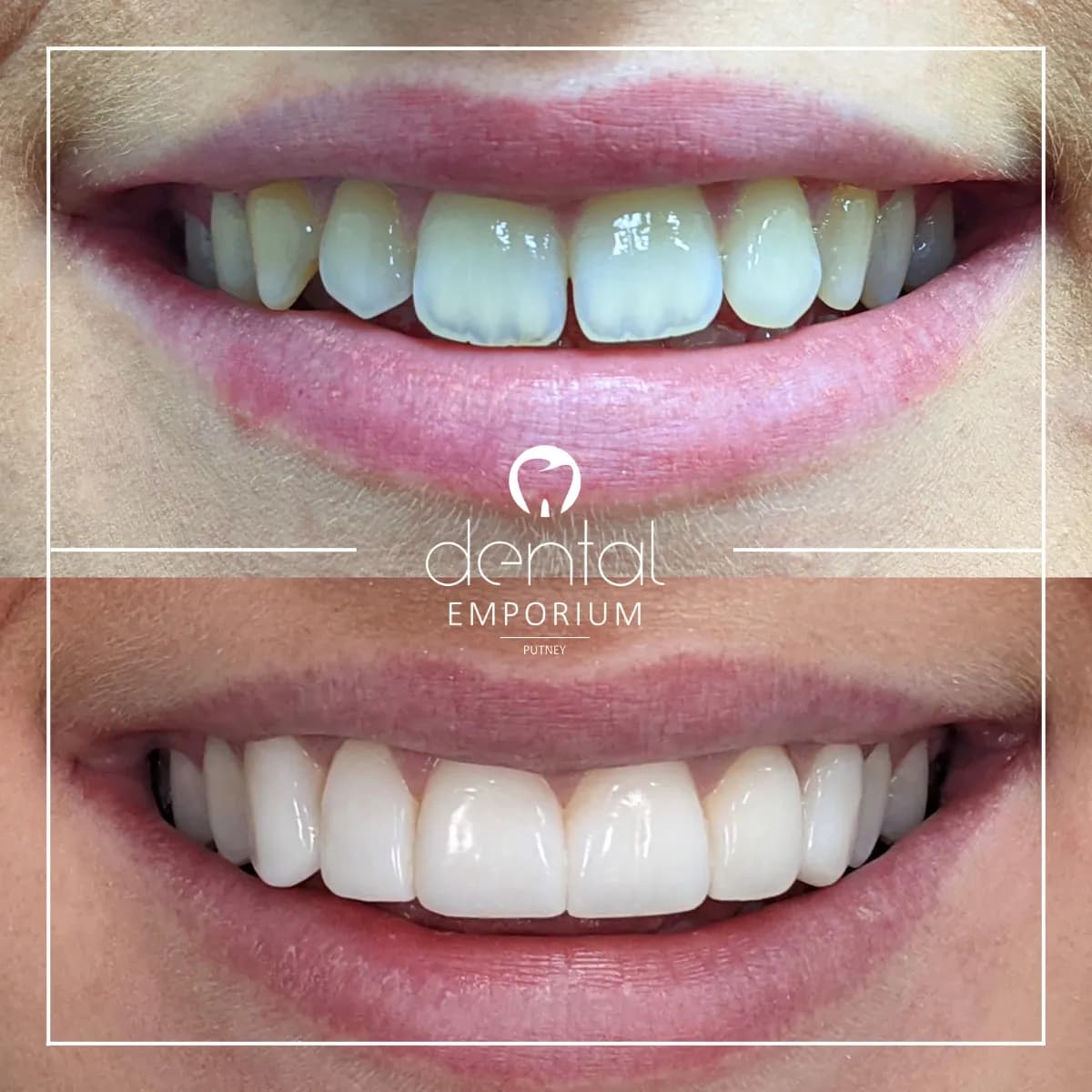 Dental Emporium Putney — photo from their Google listing