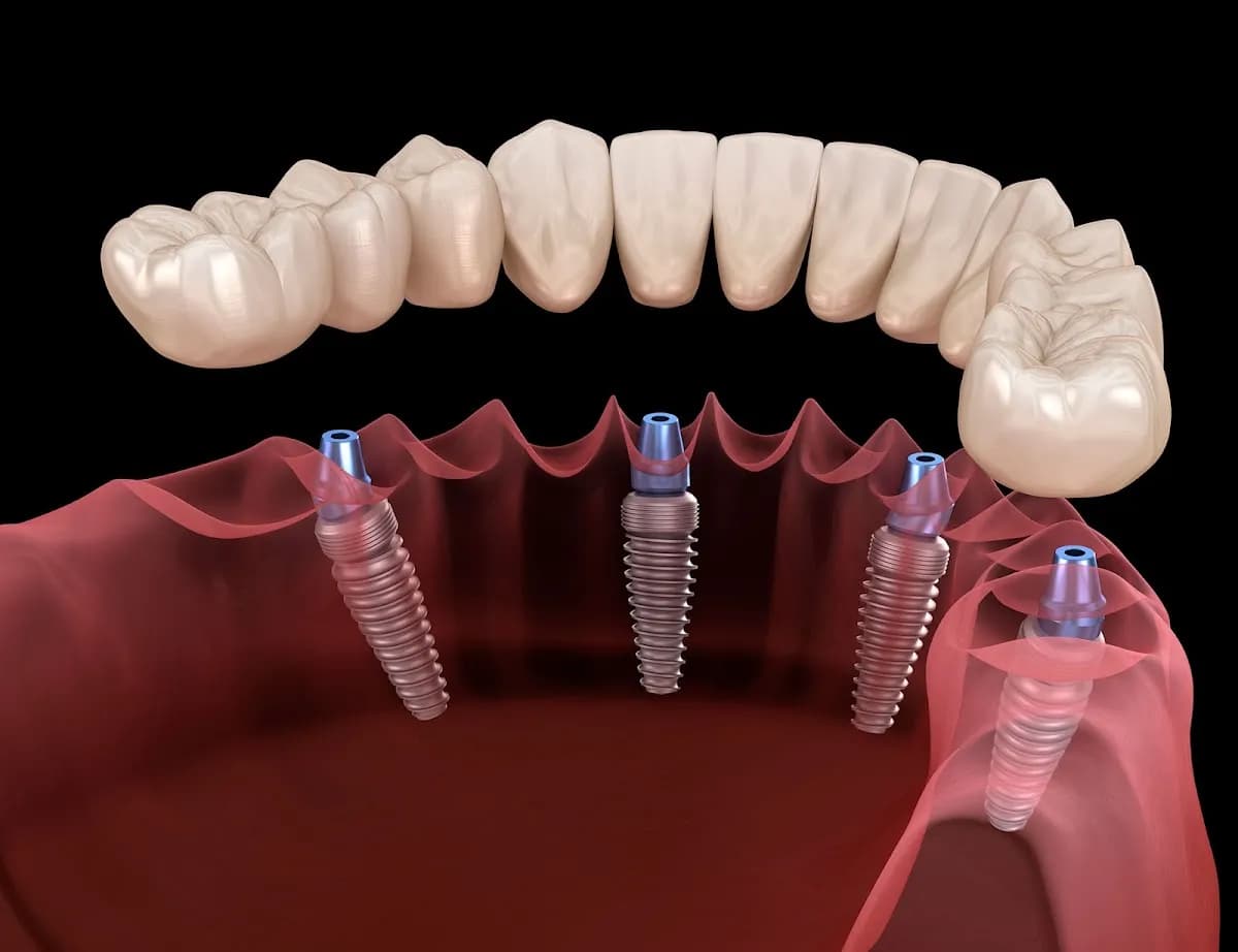 Dental Implant Centre Aberdeen — photo from their Google listing