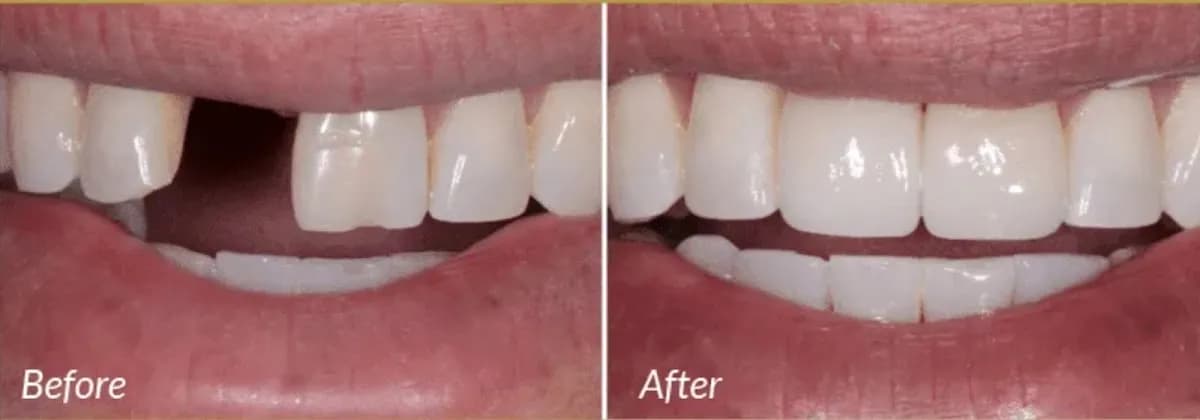 Dental Implants Leicester — photo from their Google listing