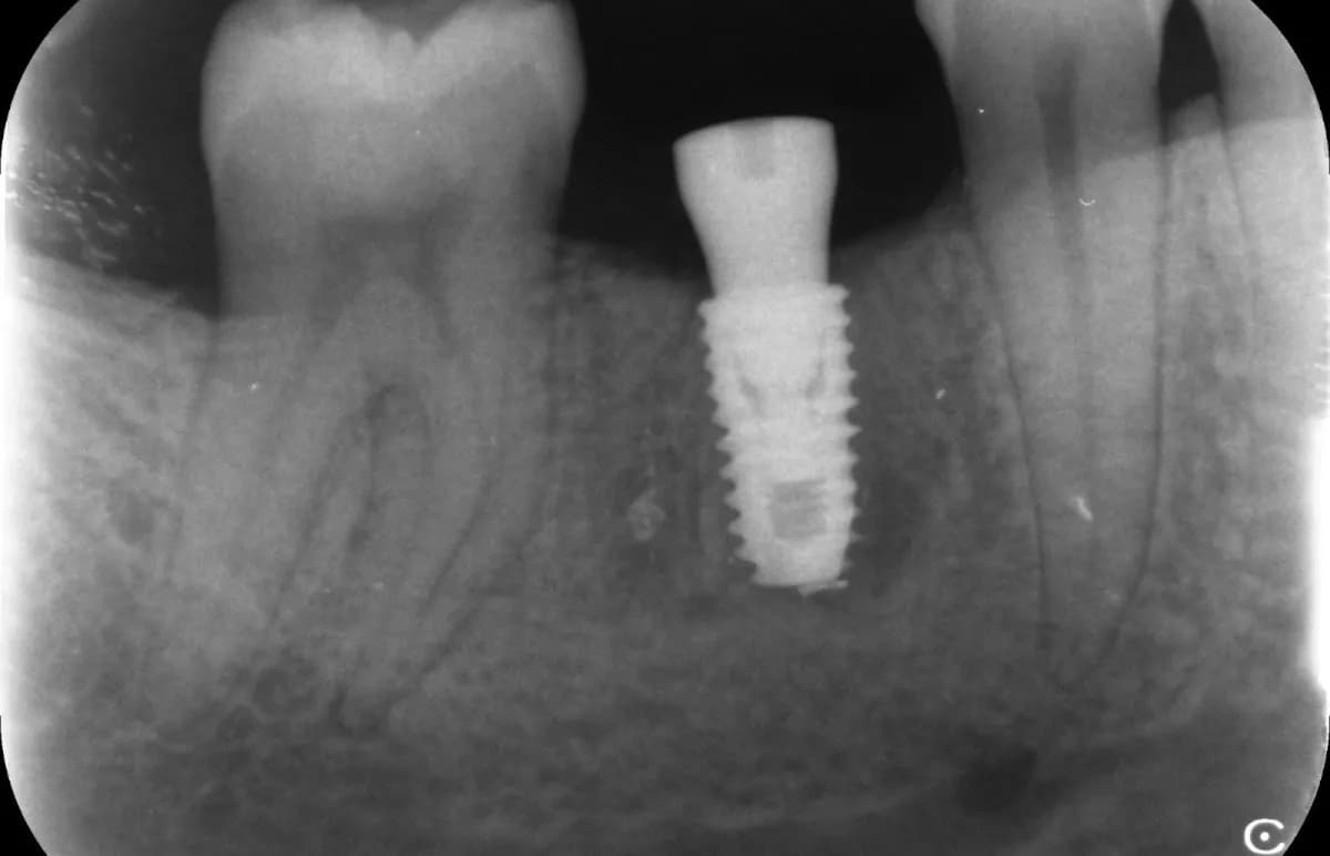 Dr Phil Dordoe Dental Implants — photo from their Google listing