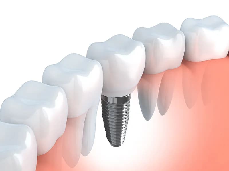 E1 Dental (New Road, Whitechapel) — photo from their Google listing