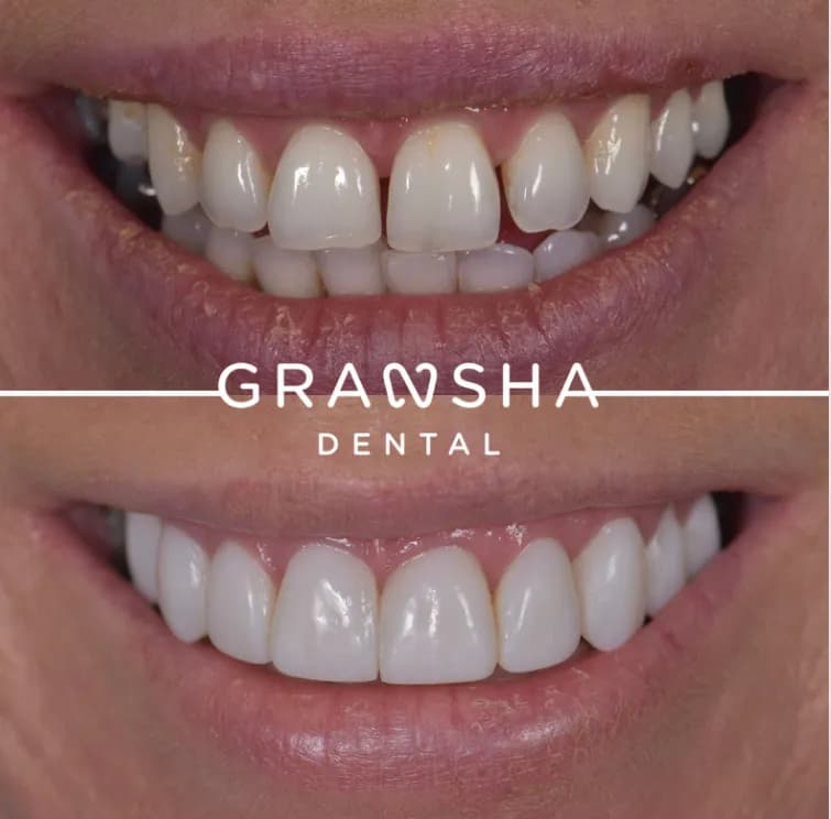 Gransha Dental — photo from their Google listing