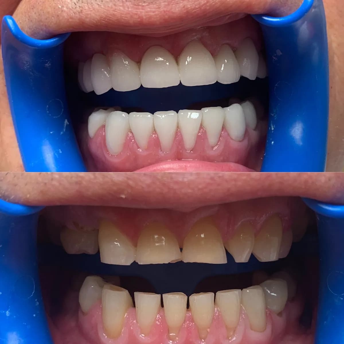 Hungary Dental Implant — photo from their Google listing