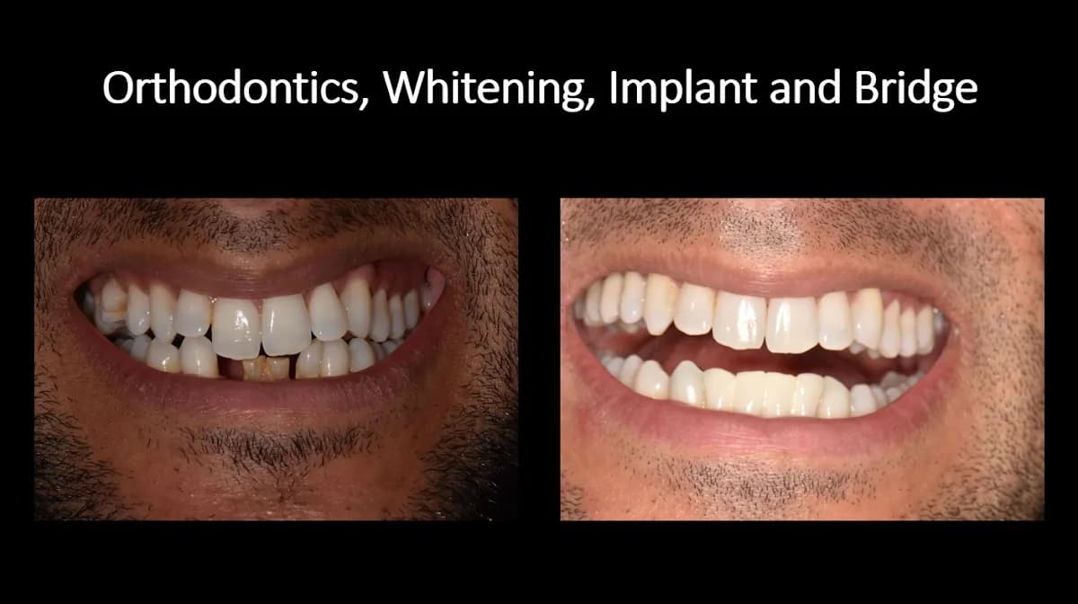Lewis Grove Dental Practice — photo from their Google listing