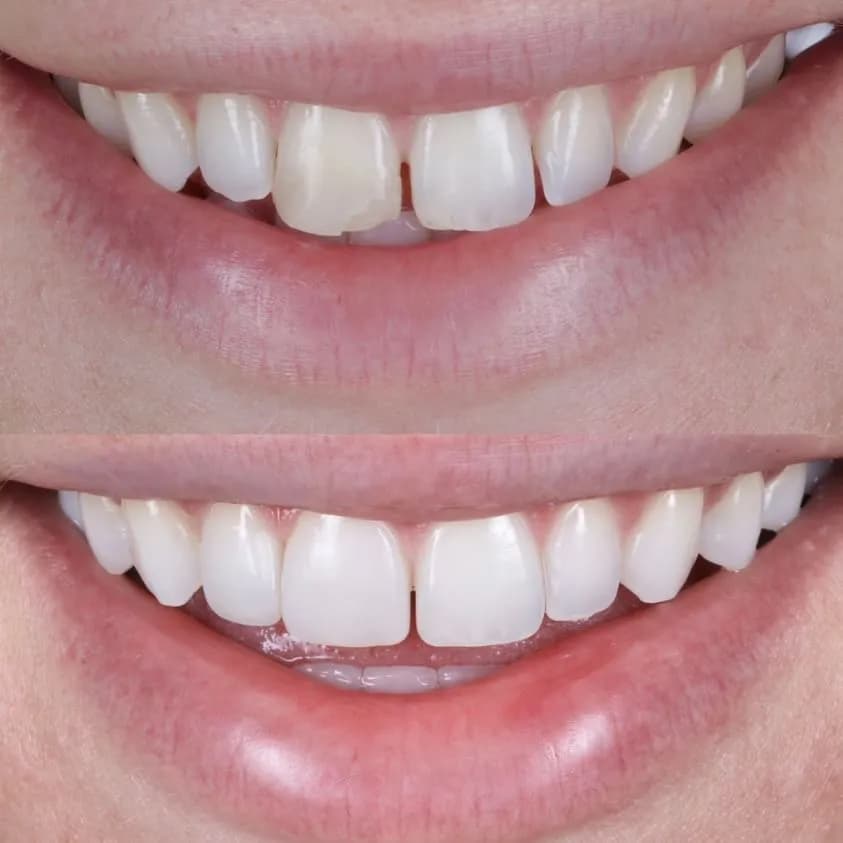 OneByOne Dental - Stranmillis — photo from their Google listing