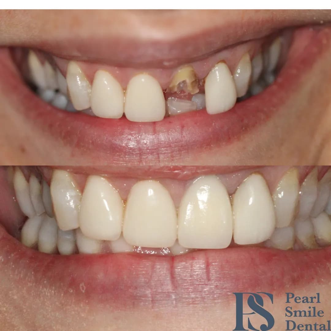 Pearl Smile — photo from their Google listing