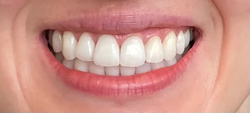 Somerhill Smiles Family Dental & Implants — photo from their Google listing