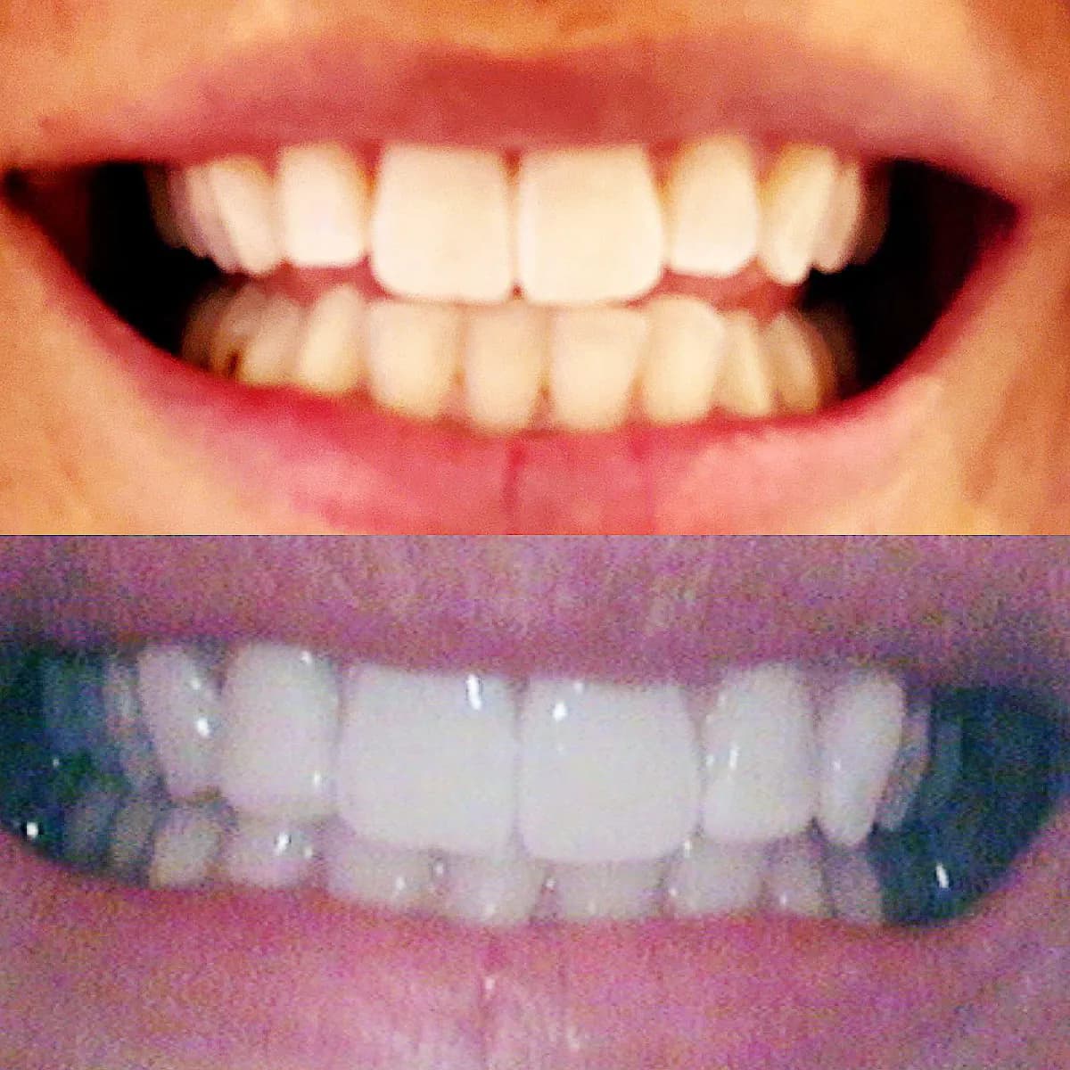 Starlite Dental Finberry — photo from their Google listing
