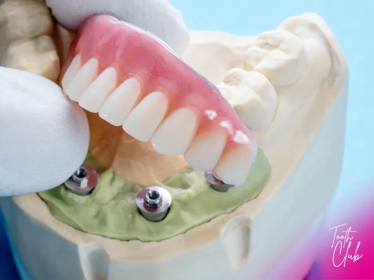 Tooth Club - Stratford Upon Avon — photo from their Google listing