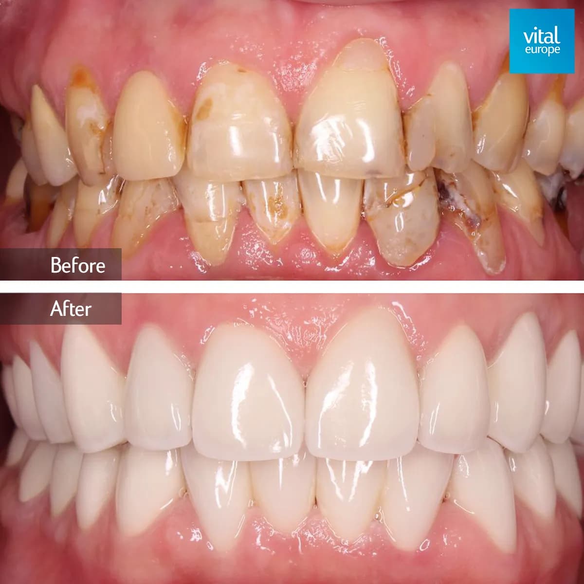 Vital Europe Dental Clinic — photo from their Google listing