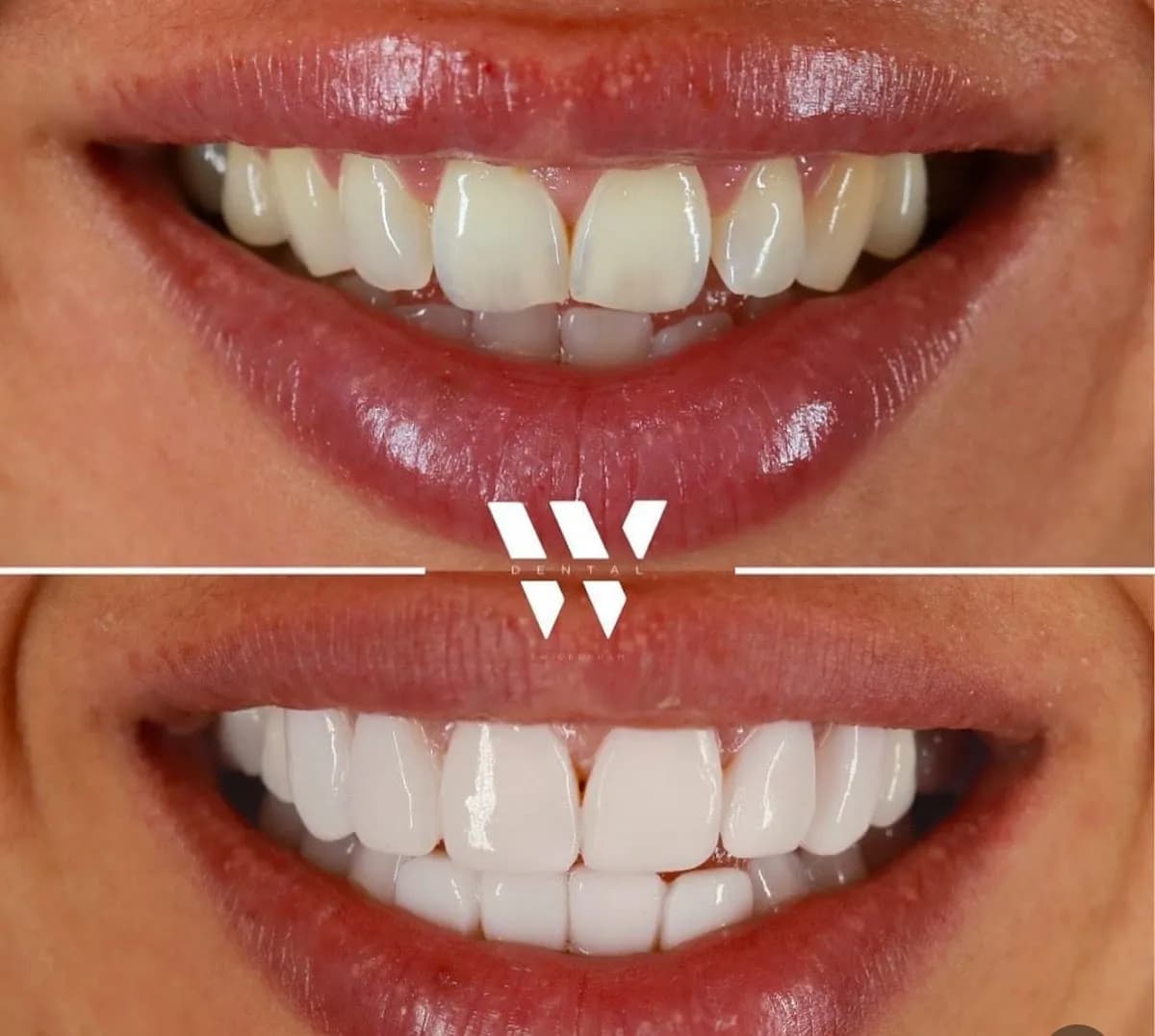 W Dental - Twickenham — photo from their Google listing