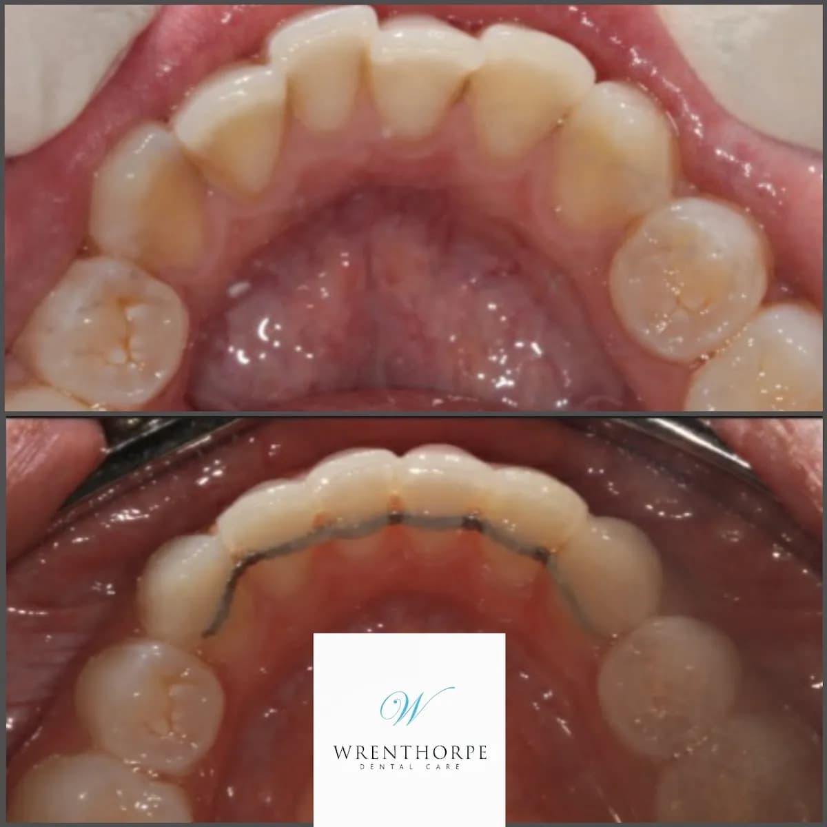 Wrenthorpe Dental Care — photo from their Google listing