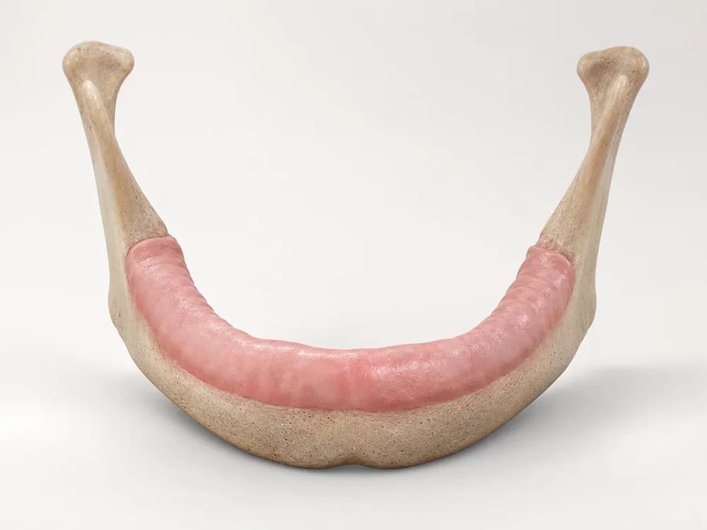 Model of a lower jawbone with no teeth, gum healed over the ridge