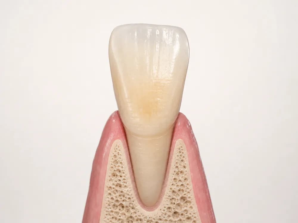 A model of a single natural upper front tooth in gum and bone