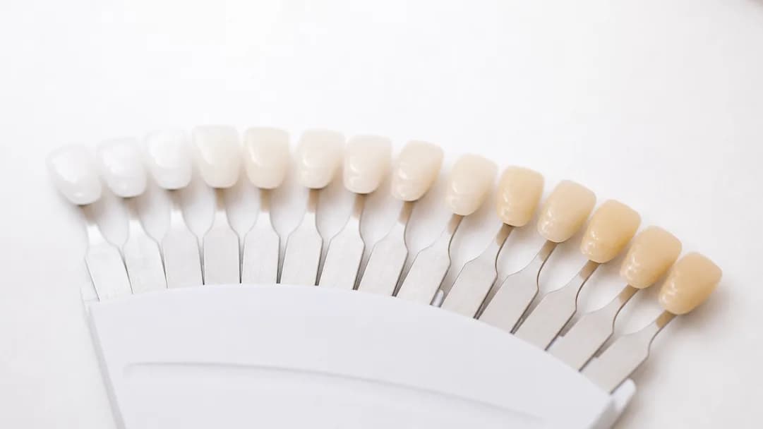 Unmarked ceramic shade tabs fanned out on a white surface under daylight