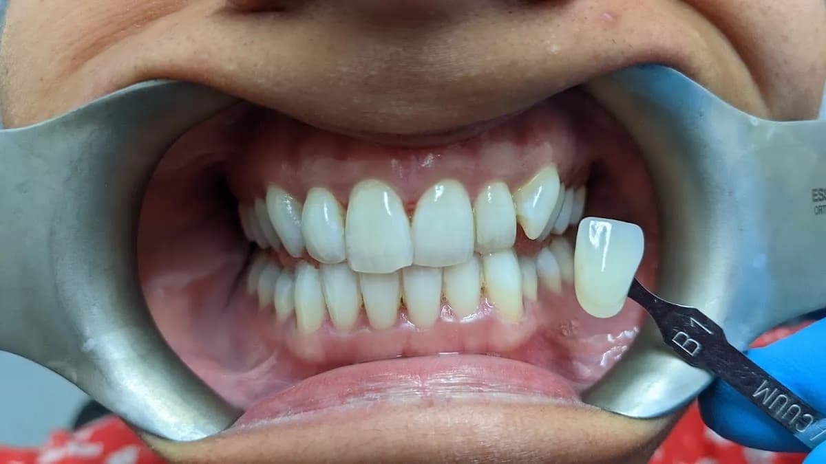 212 Dental Studio- Shaw Heath — photo from their Google listing