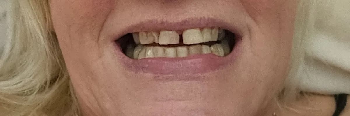 Beanhill Dental Practice - Milton Keynes — photo from their Google listing