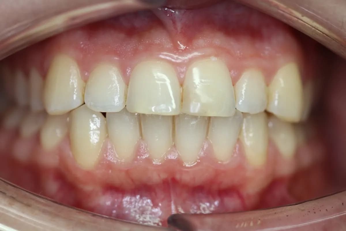 Belmont Dental Care - Dr Sreenesh Kandian & Associates — photo from their Google listing
