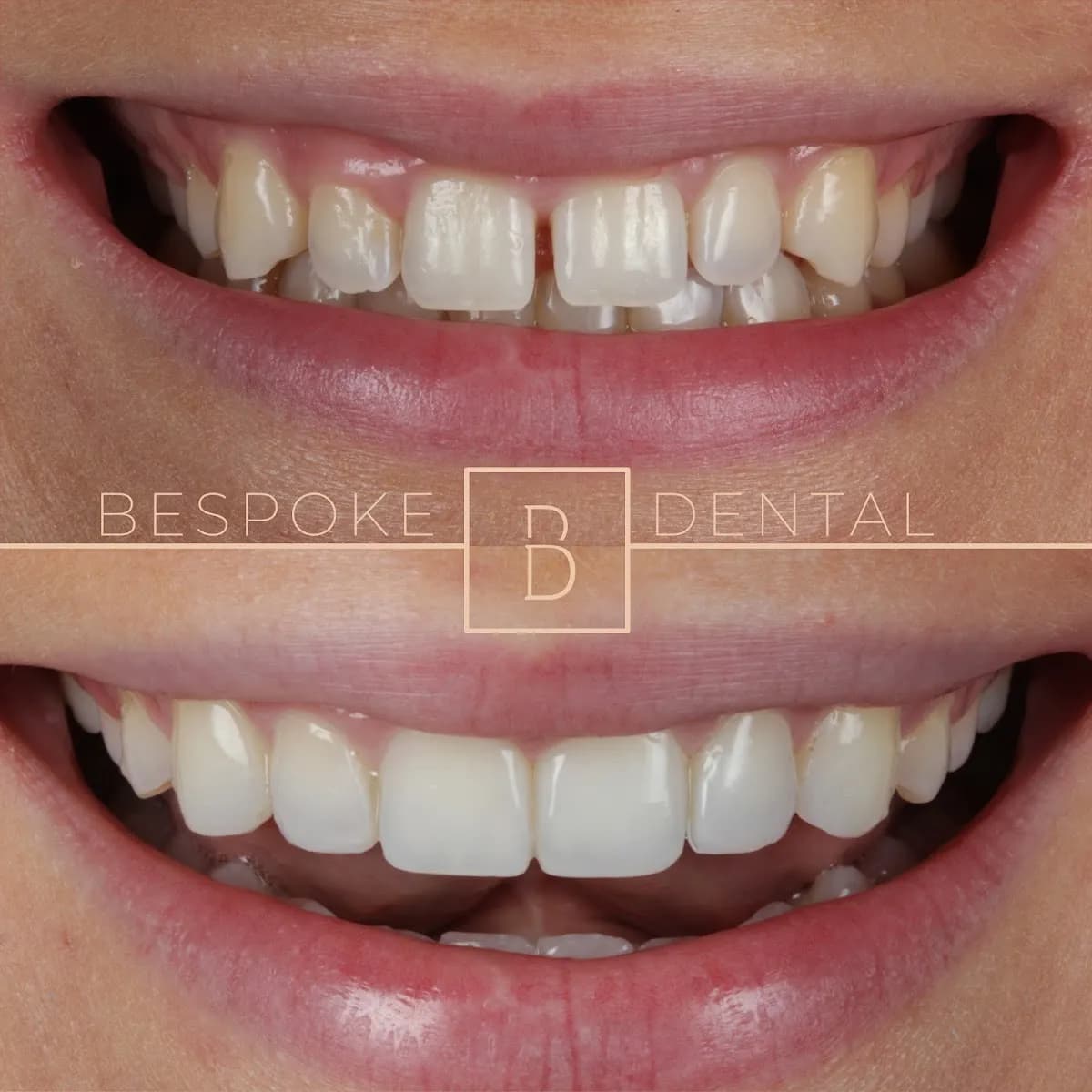 Bespoke Dental (Formerly Gentle Dental Care) — photo from their Google listing