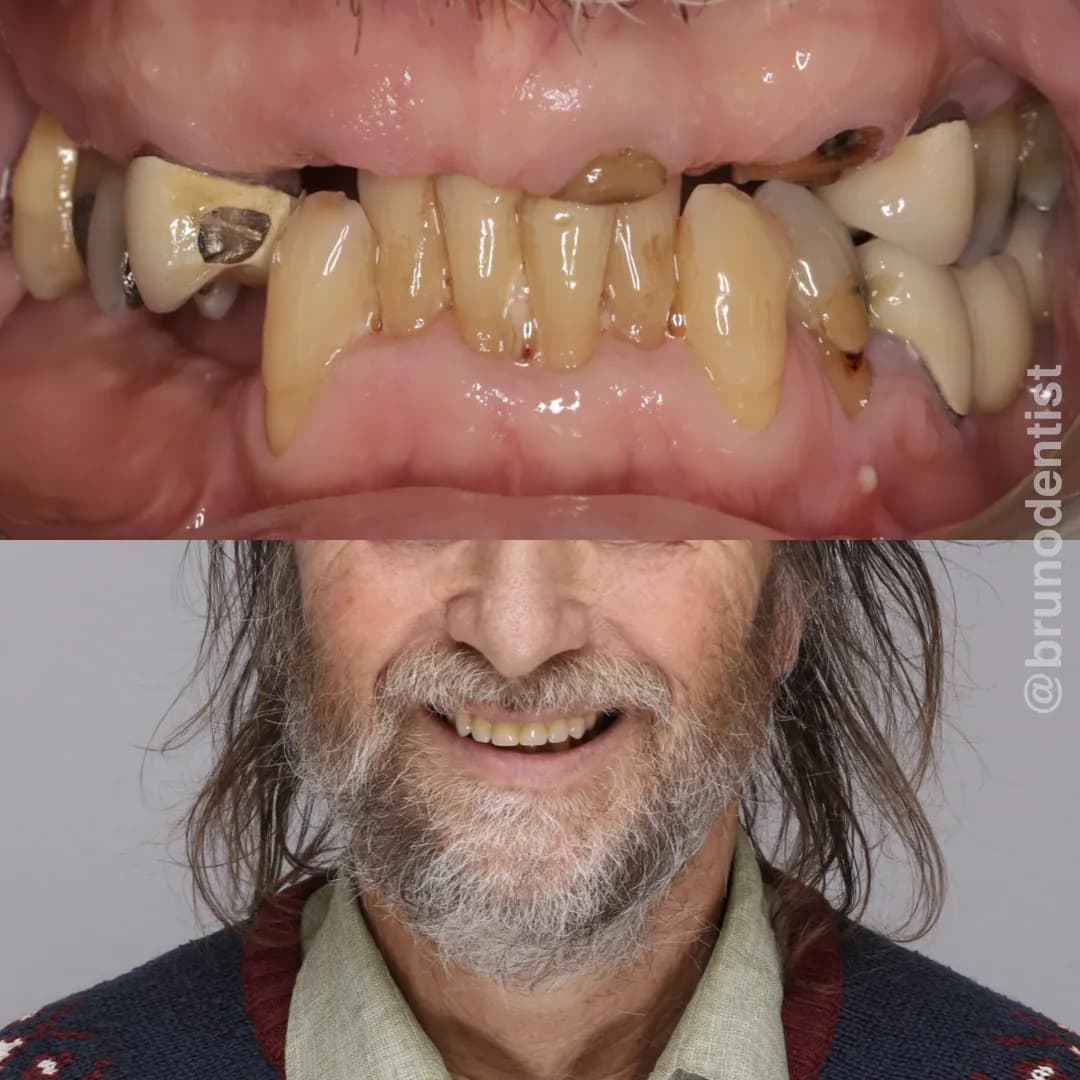 Brighton Implant Clinic (Hailsham branch) — photo from their Google listing