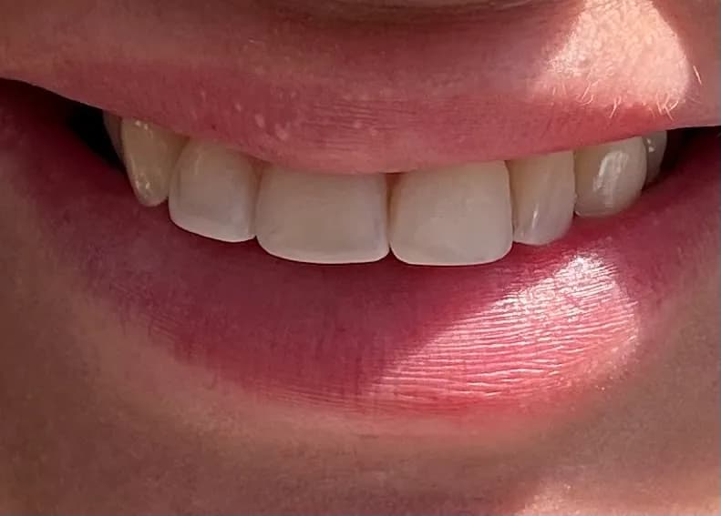 Bupa Dental Care Hull - Holderness Road — photo from their Google listing