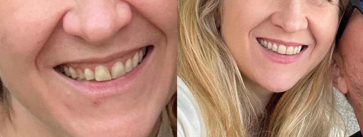 Bupa Dental Care Putney — photo from their Google listing