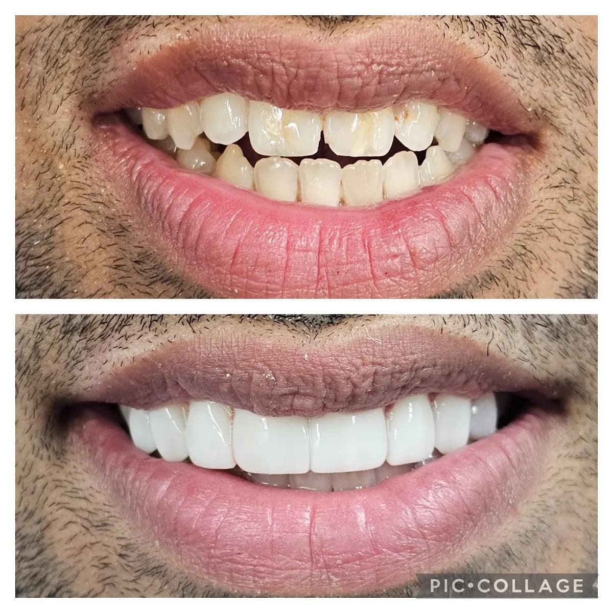 Church Lane Dental Stafford & Implant Centre — photo from their Google listing