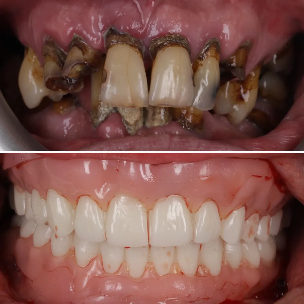 Digital dentures Glasgow, scan and fit — photo from their Google listing