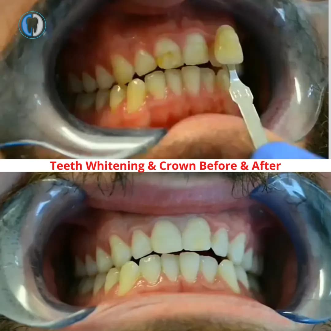 Dr Aiman Sinjab | Emergency Dentist Crewe — photo from their Google listing