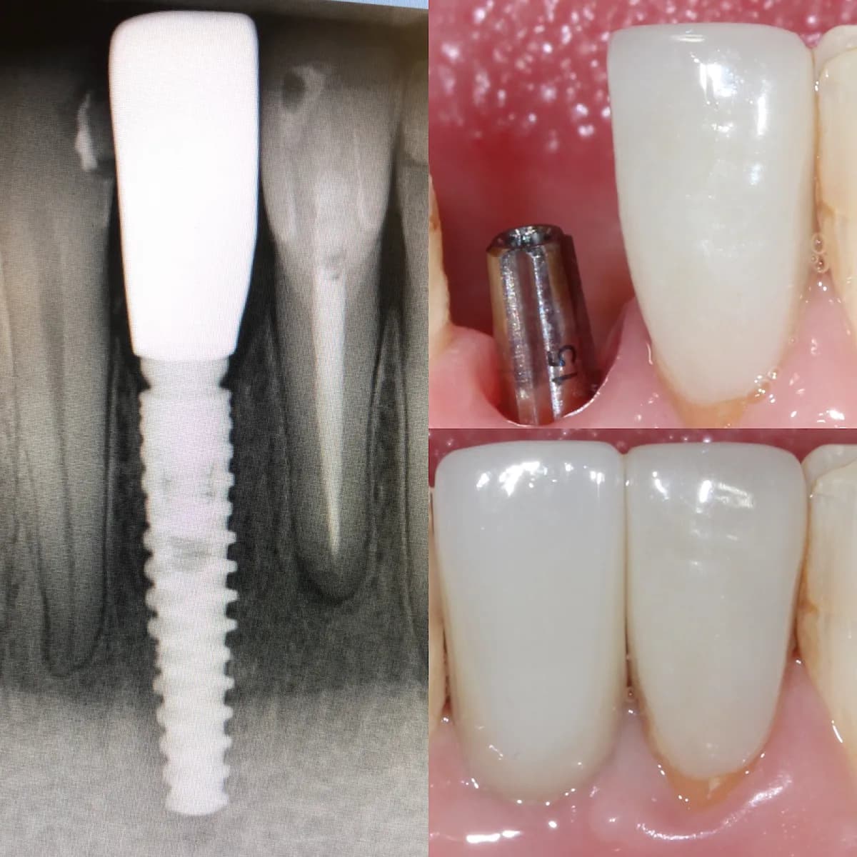 Dr Diogo Silveira. Dental Implant Clinic in Battersea — photo from their Google listing