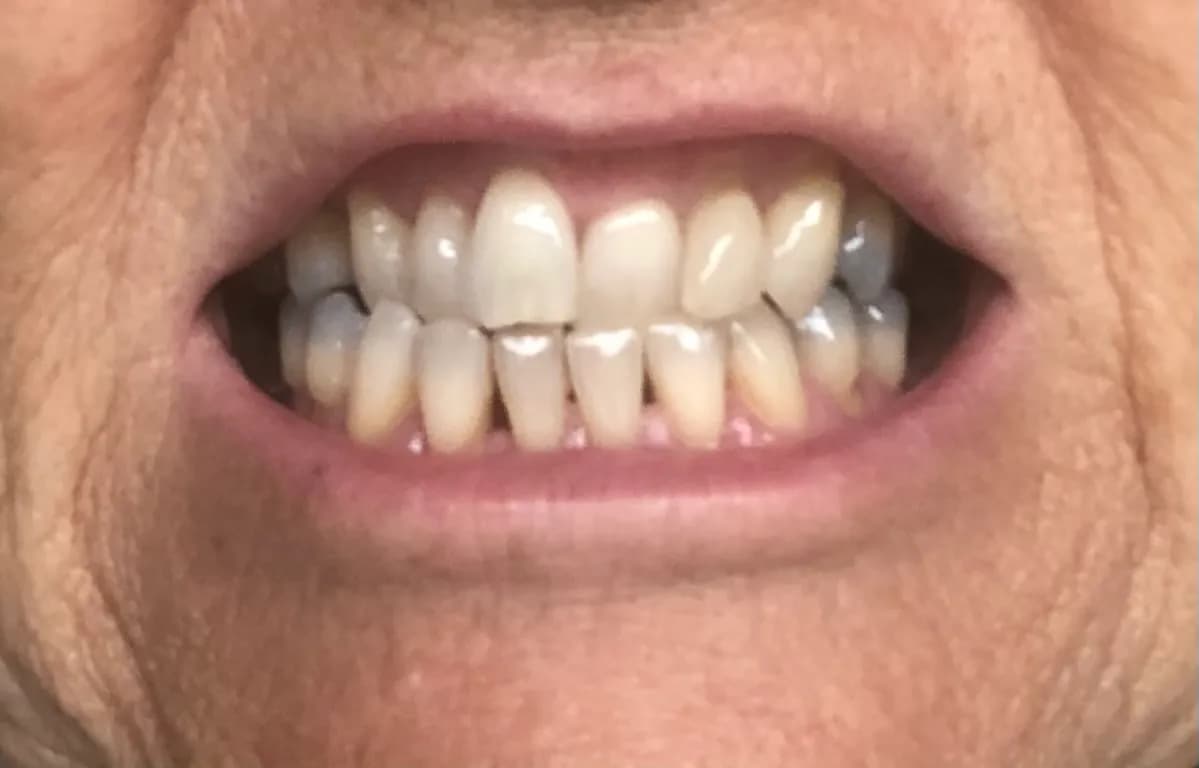 Etwall Dental Practice - General & Cosmetic Dentistry, Teeth Straightening & Implant Clinic — photo from their Google listing