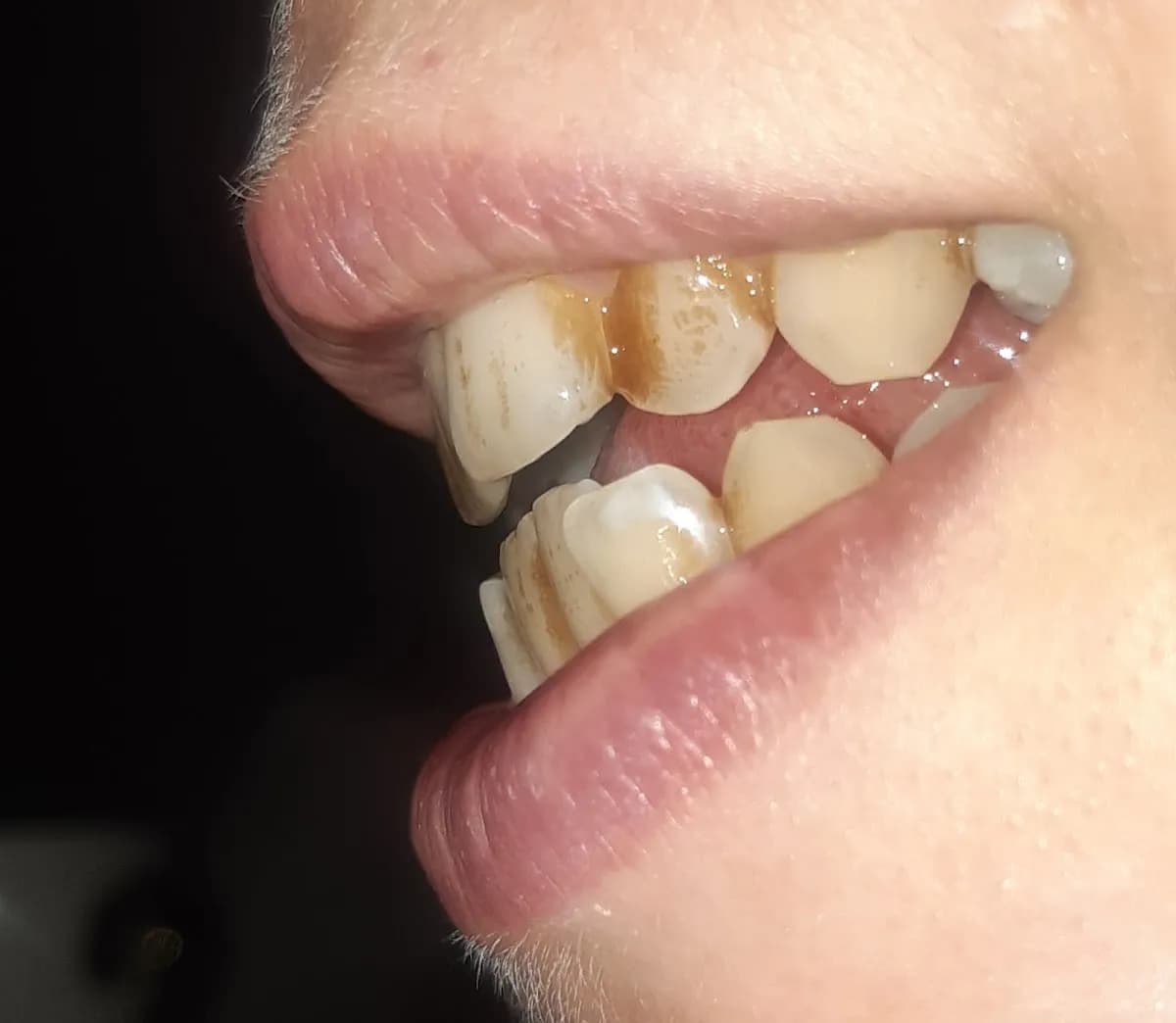 Hoe Street Dental Practice — photo from their Google listing