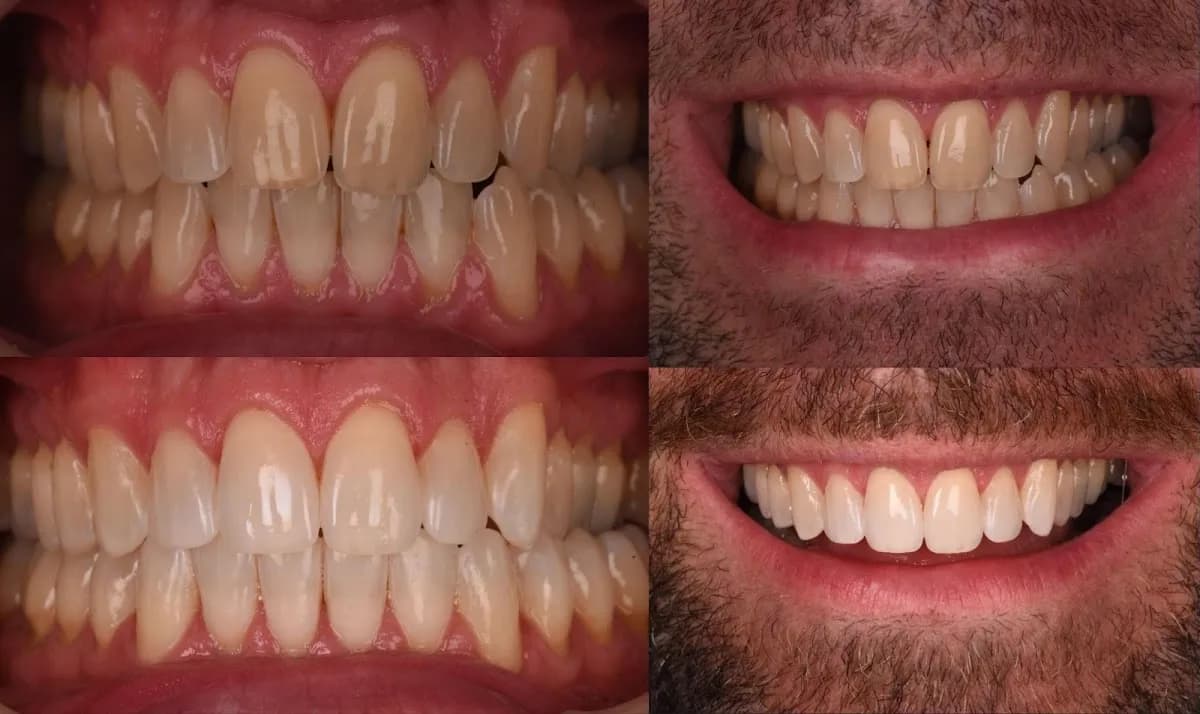 Restore.Dental | Dr. Kartik Patel | West London Invisalign — photo from their Google listing