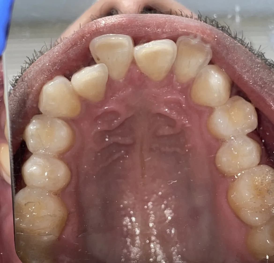 Revive Clinic Dental & Facial Aesthetics - Bayswater — photo from their Google listing