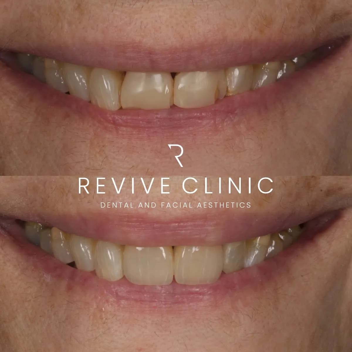 Revive Clinic Dental & Facial Aesthetics - Marylebone — photo from their Google listing