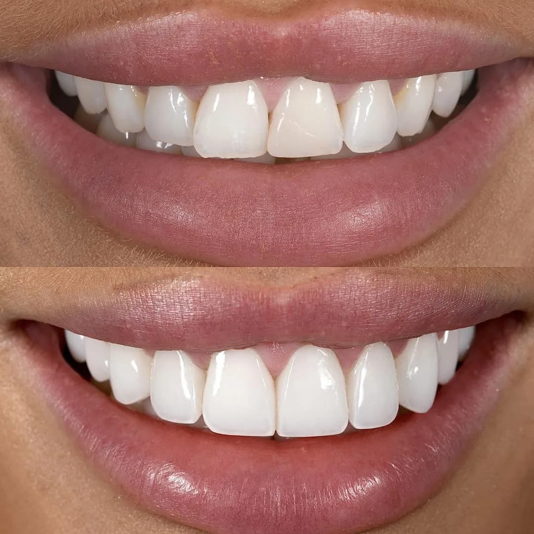 Ringway Dental - Altrincham - Cosmetic and Implant Dentistry — photo from their Google listing
