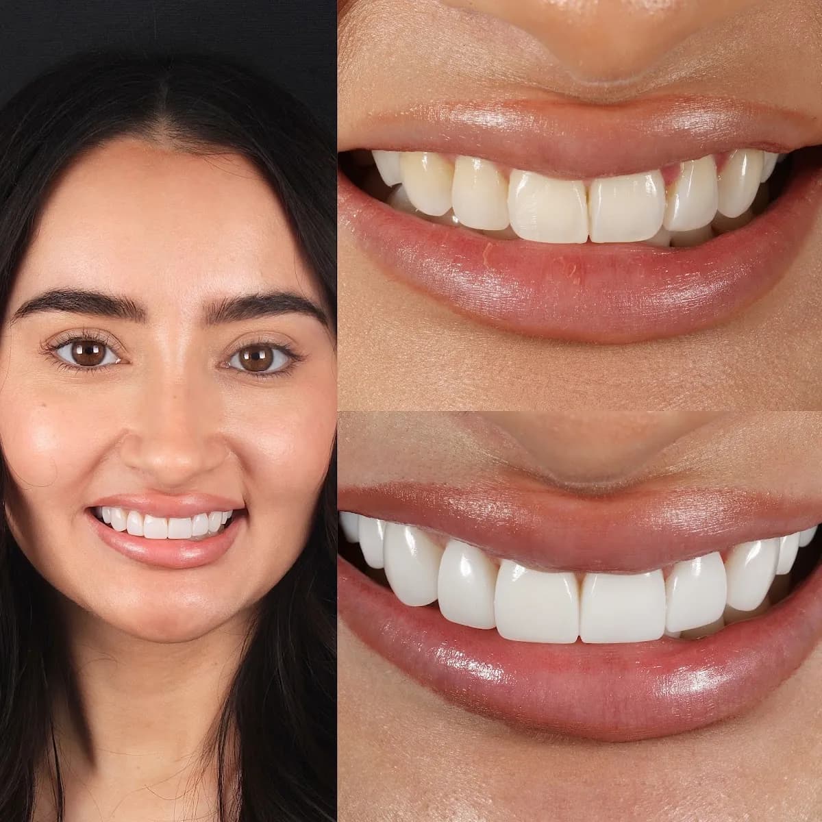 Ringway Dental - Cheadle - Cosmetic and Implant Dentistry — photo from their Google listing
