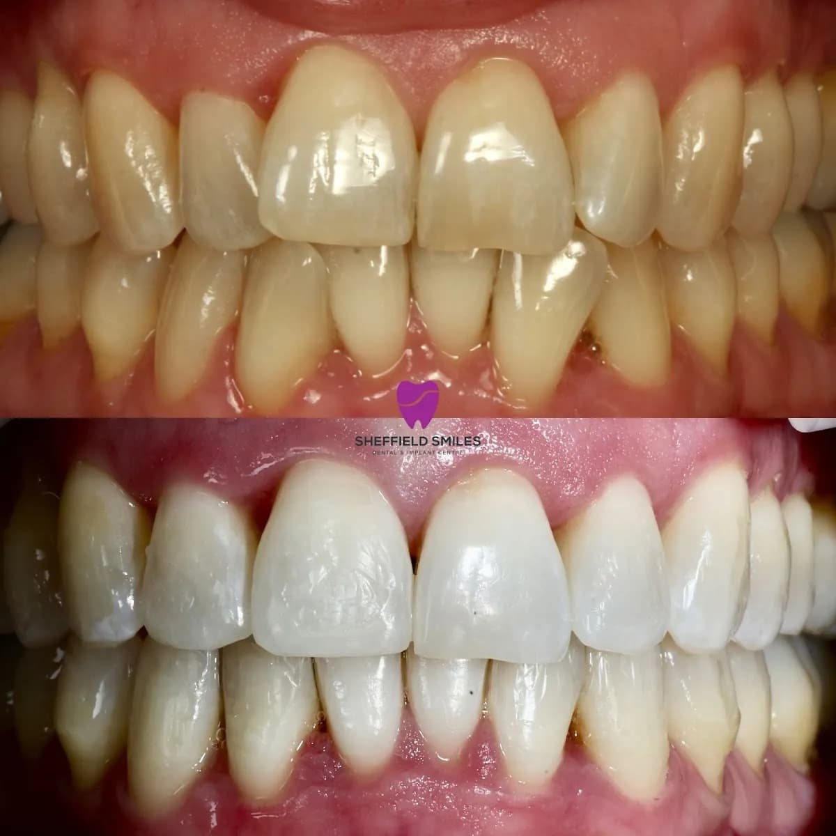 Sheffield Smiles Dental & Implant Centre — photo from their Google listing