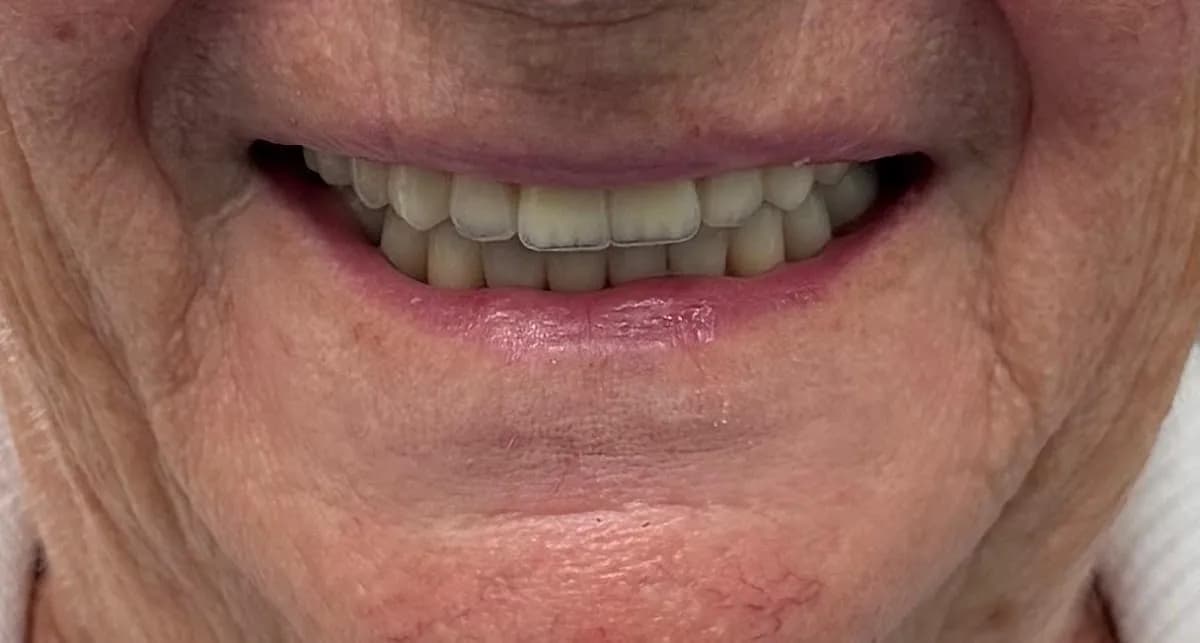 Smile2Day | Implant and Emergency Dentist — photo from their Google listing