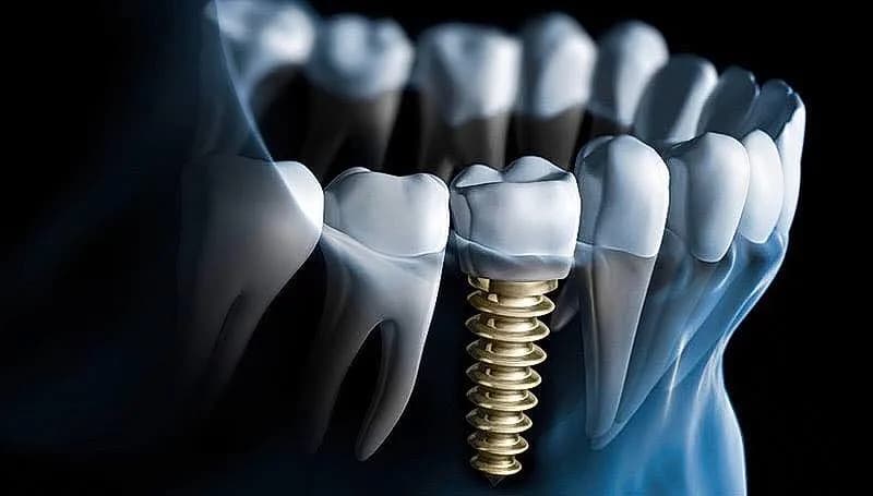 The Anchorage Dental Care & Implant Centre — photo from their Google listing