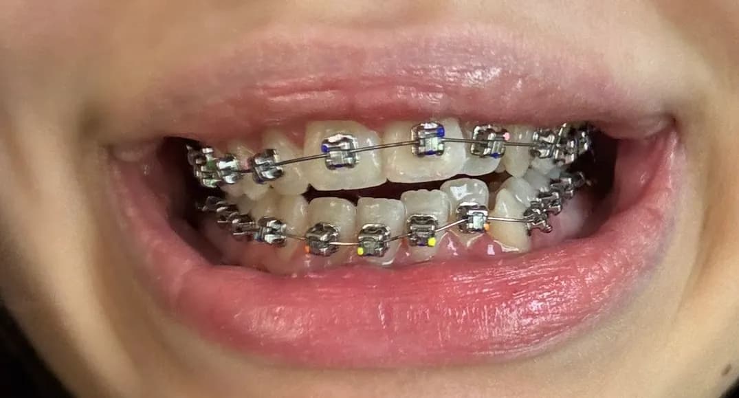 Thousand Smiles | Invisalign Offer, Orthodontic and Implant centre — photo from their Google listing